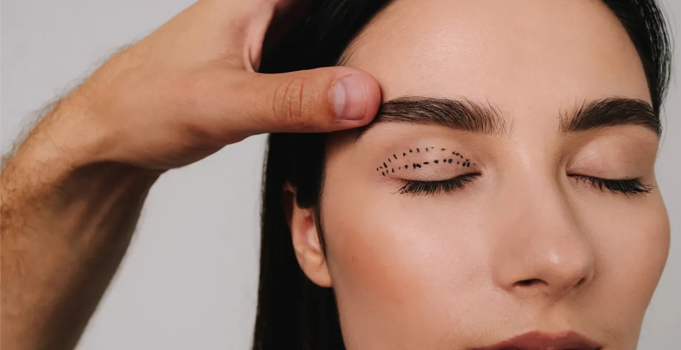 Blepharoplasty consultation in Penarth near Cardiff.